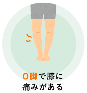O脚で膝に痛みがある